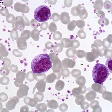 Neutrophil_myelocyte