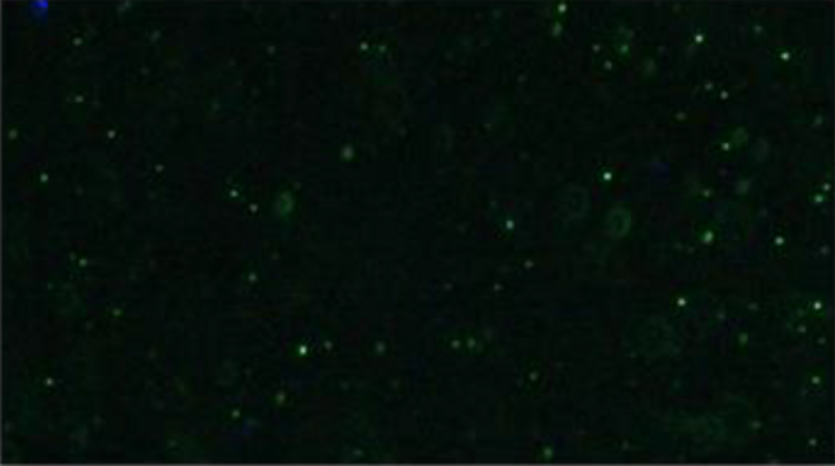 図2 エクソソームのカメラ画像