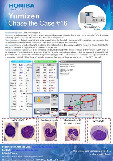 HORIBA Medical Chase the Case #16 (EN) - Chediak-Higashi Syndrome