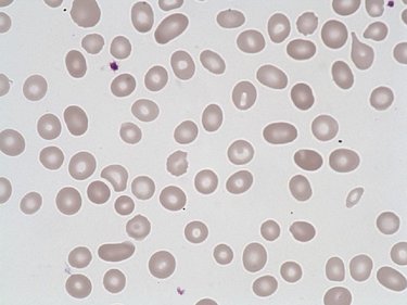 Elliptocyte