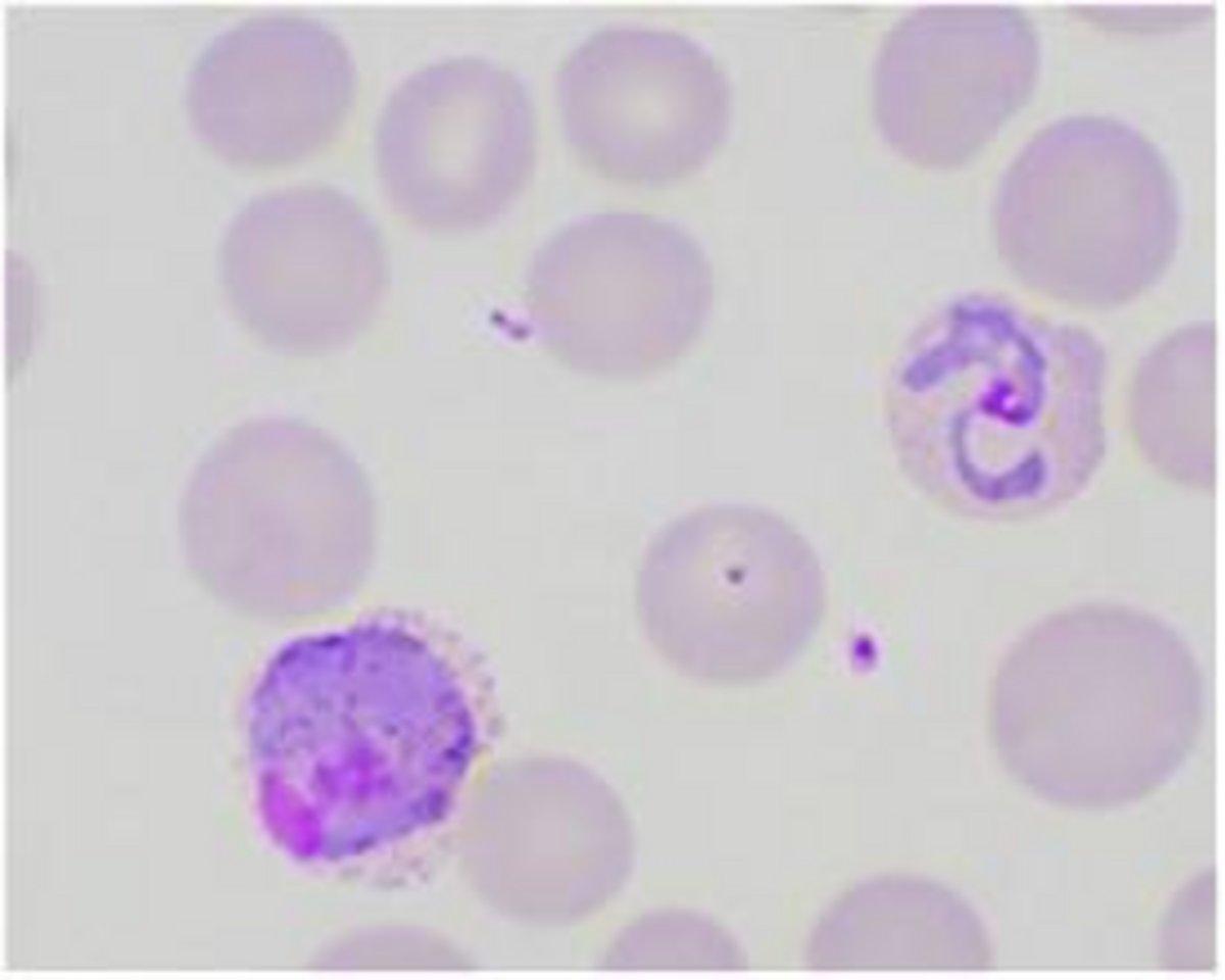 Blood Smear Malaria Image & Photo (Free Trial) | Bigstock