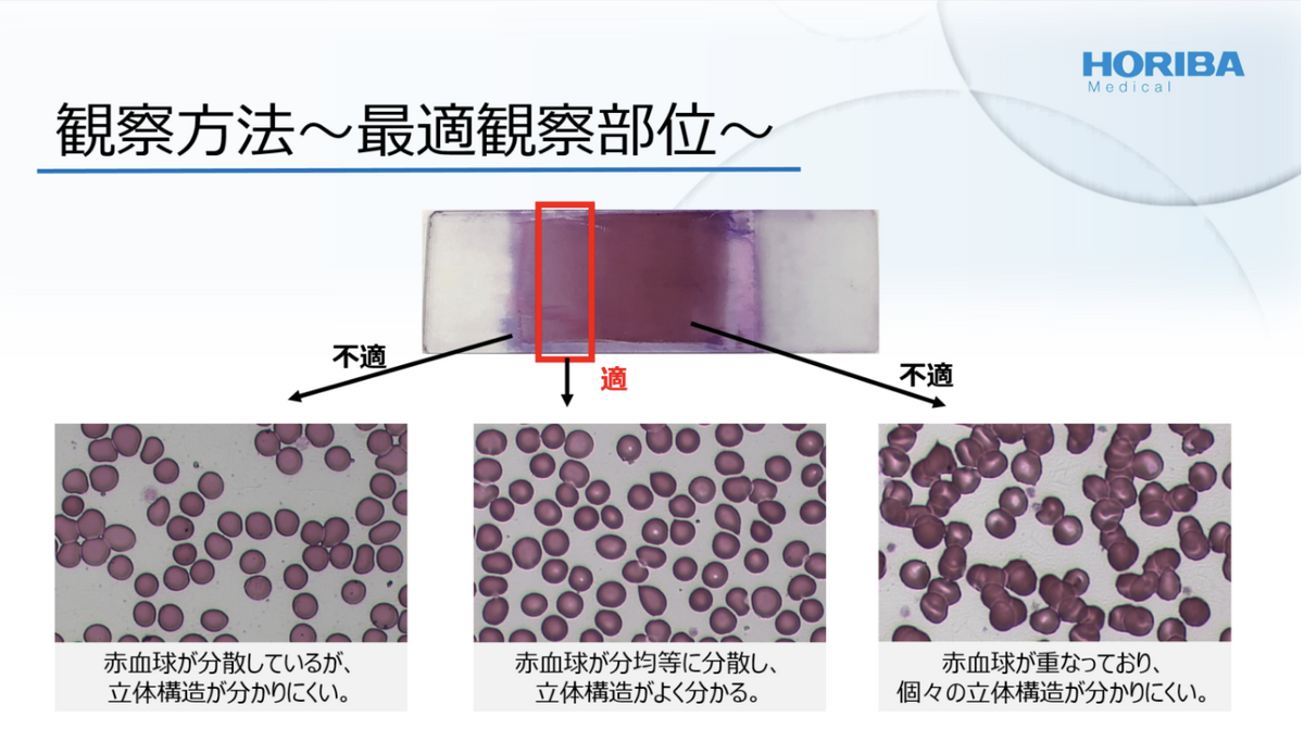 図2　人の血液塗抹標本における最適観察部位（モノレイヤー）
