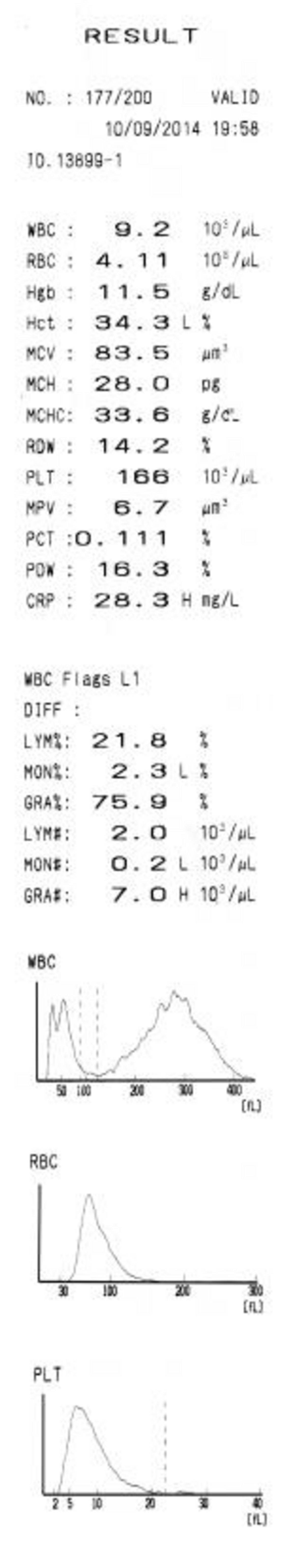 Examples of pathological cases-left