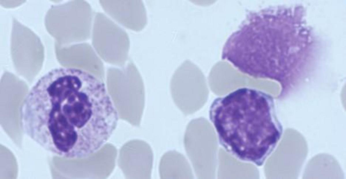 abc cell image - QSP Newsletter 31 abc cell image - QSP Newsletter 31