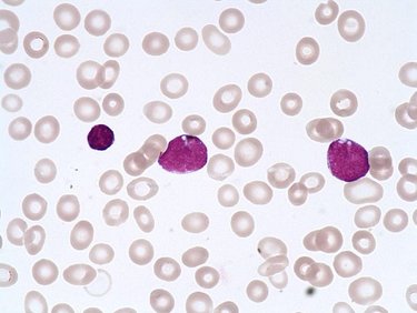 Lymphoblast